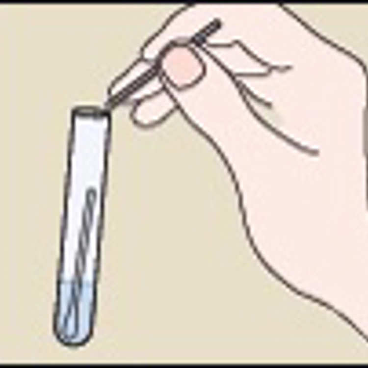 Chlamydia Test