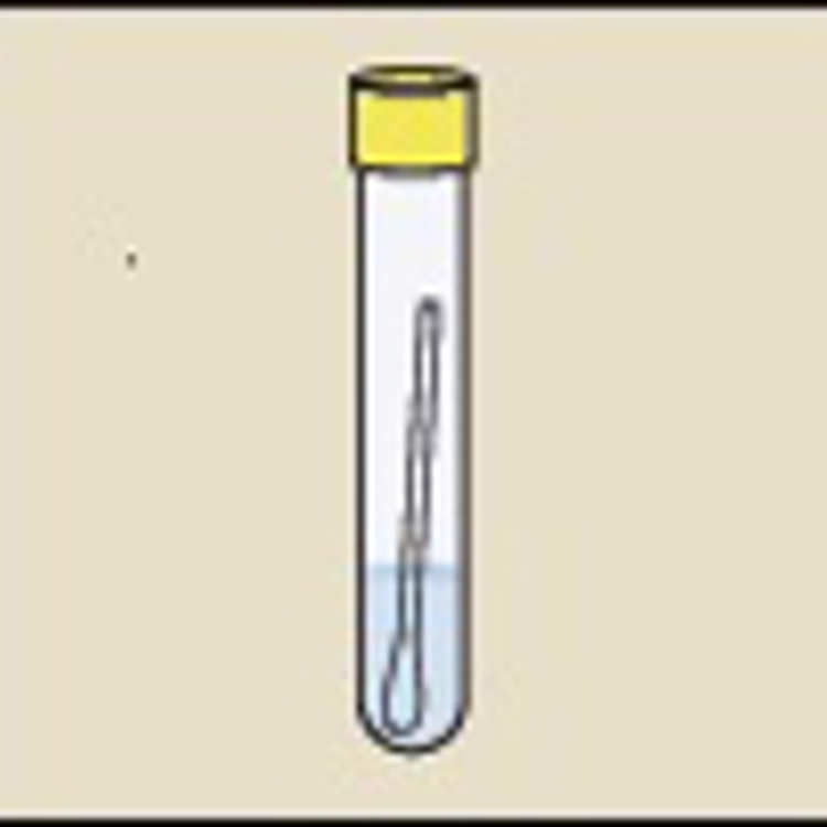 Chlamydia Test