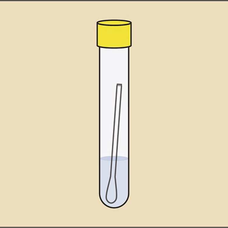 STI Testing | Postal chlamydia and gonorrhoea testing | BPAS