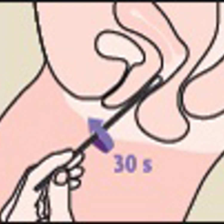 Chlamydia test in vagina