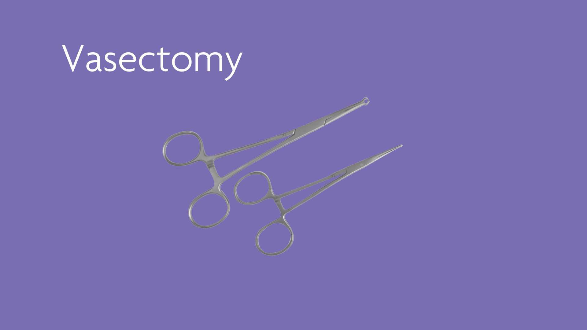 Vasectomy