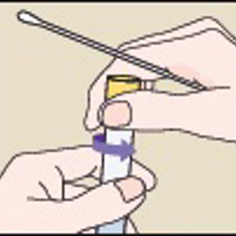 Chlamydia Test