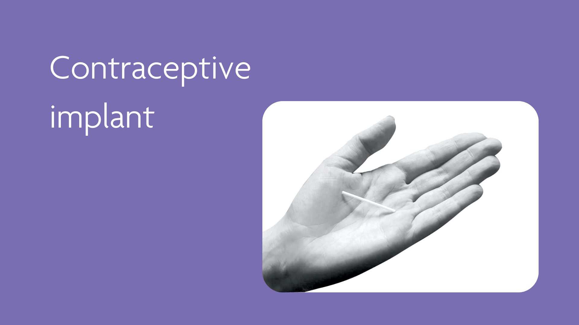 Contraceptive Implant